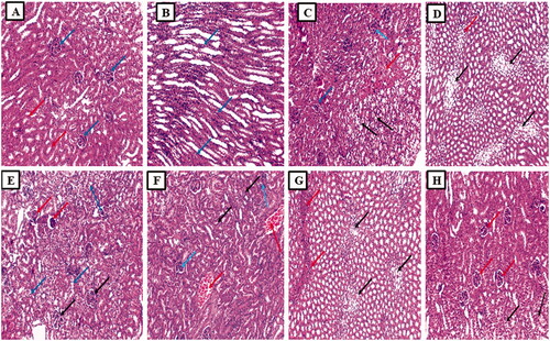 Figure 7. Histopathological examination of the kidney sections. (A) The section in the cortex of kidney of the normal control group showed average-sized glomeruli (blue arrows) surrounded by average-sized tubules lined with columnar cells (red arrows) (H and E, ×100). (B) Section in the medulla of kidney of the normal control group showed average-sized tubules lined with columnar cells (blue arrows) (H and E, ×100). (C) Section in the cortex of kidney of cisplatin group showed a focal area of necrosis (red arrow) surrounded by atrophic glomeruli (blue arrows) and tubules showing hydropic degeneration (black arrow) (H and E, ×100). (D) Section in the medulla of kidney of cisplatin group showed tubules with ballooning degeneration (marked hydropic degeneration) (black arrows) and focal inflammatory cellular infiltrate (red arrow) (H and E, ×100). (E) Section in the cortex of kidney of placebo PLGA NCs group showed congested vessels (red arrows) surrounded by atrophic tubules (atrophic tubules) and some atrophic glomeruli (blue arrows) and tubules showing hydropic degeneration (black arrow) (H and E, ×100). (F) Section in the medulla of kidney of placebo PLGA NCs group showed tubules with ballooning degeneration (marked hydropic degeneration) (black arrows) and inflammatory cellular infiltrate (red arrows) (H and E, ×100). (G) Section in the kidney of free EGCG group showed average-sized glomeruli (black arrows) and some atrophic glomeruli (red arrows) surrounded by average-sized tubules and some showing hydropic degeneration (blue arrows) (H and E, ×100). (H) Section in the kidney of EGCG PLGA NCs (F2) group showed average-sized glomeruli (red arrows) surrounded by average-sized tubules and few showing hydropic degeneration (black arrows) (H and E, ×100).