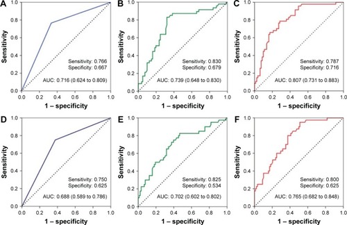 Figure 4 ROC curve analysis for MVI and exosomal miR-125b in HCC patients (n=128; cohort 2).