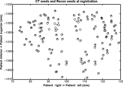 Figure 5. Reconstructed seed locations (×) compared with “gold standard” CT seed locations (o) at registration.