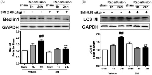 Figure 5. Effects of Shengmai injection (SMI) on the expression of Beclin1 (A) and LC3 (B) in C57 mice subjected to tMCAO/R. The mice were subjected to 1h of ischemia and 24 h of reperfusion (tMCAO/R). SMI (5.68g/kg, ip) was administered after 1 h of ischemia. Representative Western blot analyses showing the levels of Beclin1 and LC3. GAPDH is shown to verify protein loading. The data are the mean ± SD, n = 3. ##p < 0.01 versus sham-operated mice, **p < 0.01 versus tMCAO/R mice.