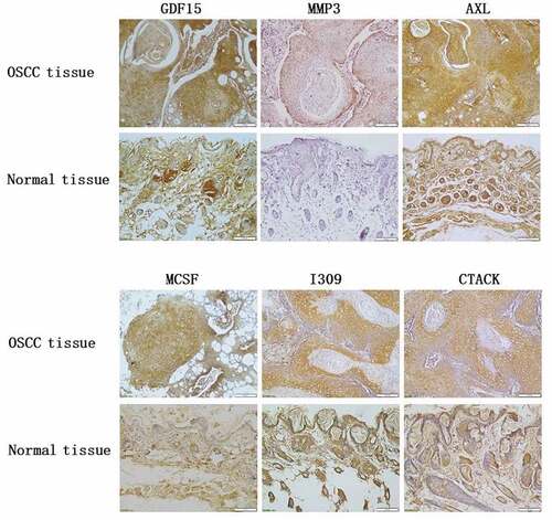 Figure 9. Immunohistochemical analysis of key proteins in OSCC nude mouse
