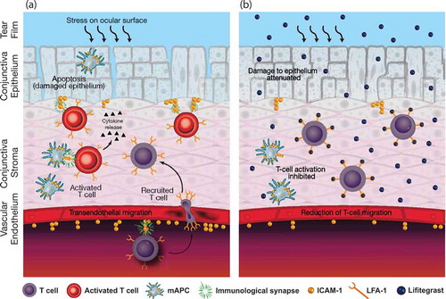 Figure 1. Current understanding of the mechanism of action of lifitegrast in DED. (a) In DED, stress to the ocular surface can result in overexpression of ICAM-1. This leads to increased migration of T cells to the ocular surface, activation of T cells through the formation of immunological synapses, and the release of pro-inflammatory cytokines, which can cause damage to the ocular tissues. (b) Lifitegrast is thought to reduce T-cell migration, T-cell activation, and pro-inflammatory cytokine release by blocking LFA-1/ICAM-1 interaction. DED: dry eye disease; ICAM-1: intercellular adhesion molecule-1; LFA-1: lymphocyte function-associated antigen-1; mAPC: mature antigen-presenting cell. Adapted with permission from Perez et al., Lifitegrast, a novel integrin antagonist for treatment of dry eye disease. Ocul Surf; 2016; 14; 207–215 [Citation14]. DOI: http://dx.doi.org/10.1016/j.jtos.2016.01.001.