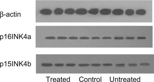 Figure 5 Western blot analysis of p16INK4a and p15INK4b expression in cancer cells.