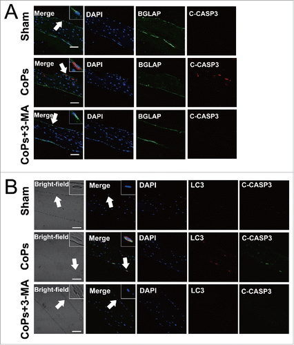 Figure 7. Autophagy mediated the upregulation of CoPs-induced osteoblast apoptosis in vivo. (A) Immunofluorescence was performed to determine the expression of cleaved CASP3 in osteoblasts. Sections of murine calvaria are presented for the animals from each group. Scale bar: 50 µm. Red, cleaved CASP3 (C-CASP3); green, osteoblasts (BGLAP); blue, DAPI nuclear staining. (B) Immunofluorescence was performed to determine the colocalization of LC3 and cleaved CASP3 in osteoblasts. Sections of murine calvaria are presented for the animals from each group. Scale bar: 50 µm. Red, LC3; green, cleaved CASP3 (C-CASP3); blue, DAPI nuclear staining.