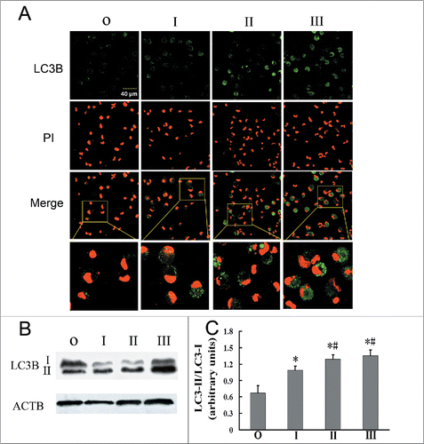 Figure 1. Autophagosomes increase in AMs with the development of silicosis. (A) A representative image of fixed alveolar macrophages from different groups stained for LC3B (original magnification ×600). Green, LC3B protein; Red, PI-labeled nuclei; PI was used for nuclear staining. Scale bar: 40 μm. (B) AMs from observers and different silicosis stages were analyzed for LC3B by western blot. ACTB/beta-actin protein was used as a loading control. (C) LC3-II/LC3-I ratios for each patient group. Significance was determined using one-way ANOVA (n = 11 for the observer group; n = 14 for stages I, II and III. *, P < 0.05 compared to the observer group，#, P < 0.05 vs. stage I patient group. O, observer group; I, stage I patient group; II, stage II patient group; III, stage III patient group).