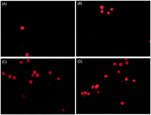 Figure 6. Cellular morphological analysis and apoptosis detection in HT29 cancer cells on treatment with zinc oxide nanoparticles by propidium iodide staining and fluorescent microscopy. Control (A), 5 μg/ml (B), 20 μg/ml (C) and 50 μg/ml (D) of ZnO nanoparticle treatment.
