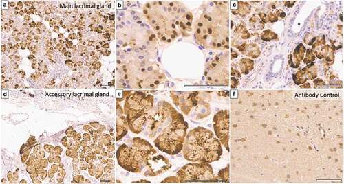 Figure 1. EP3 expression in normal main and accessory lacrimal glands of a 66-year-old body donor. (a–e), Immunohistochemistry photomicrograph shows strong expression of EP3 in more than 75% of acini’s nuclei and cytoplasm of main lacrimal gland (a & b) as well as accessory lacrimal gland (d & e). (c), Interlobular ducts (marked with asterisk) are devoid of any immunostaining. (f) represents the brain tissue taken as positive control (Scale bar = 60 microns).
