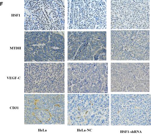 Figure 5 Knocking down HSF1 in HeLa reduces its malignancy in vivo. (A) Growth curve of nude mice with three different HeLa cells. (B) Representative images of subcutaneous tumors at day 48. Tumor volume (C) and weight (D) of HeLa cell xenografts in three different groups. The differences were statistically significant. (E) Western blot confirmed the decreased expression of HSF1, MTDH, VEGF-C and CD31 in tissues of xenograft tumors. (F) Immunohistochemistry was done to assess cyclin HSF1, MTDH, VEGF-C and CD31 expression in orthotopic tumors. Magnification 200×. Shown are the representative data sets of three independent experiments (#P< 0.05, *P < 0.05, **P < 0.01,***P < 0.001, ****P < 0.0001).