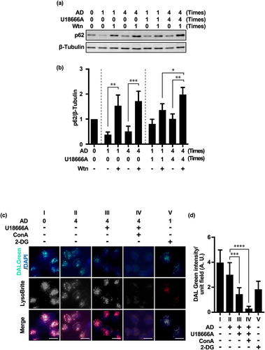 Figure 4. Repeated treatment with U18666A and AD induces MA in HeLa and MCF-7 cells. (a) Western blot image of p62 in HeLa cells after U18666A treatment (first time, 5 μg/mL, 5 h exposure; second and subsequent times, 2 μg/mL, 3 h exposure) followed by washing and 5 h of AD exposure. (b) Quantification of p62 degradation and accumulation. Results are expressed as the mean ± SD of three independent experiments. (c) In the fourth treatment, HeLa cells after three treatments with U18666A and AD were pretreated with EBSS alone (panel II), U18666A (2 μg/mL) and ConA (5 nM) for 3 h, respectively, washed and then treated with EBSS alone (panel III) or EBSS with ConA (panel IV) for 5 h, or pretreated with 2-DG (1 mM) for 3 h followed by EBSS (panel V) for 5 h. Note: panel I shows cells cultured under non-AD conditions (DMEM with 10% serum). Autolysosomes and functional lysosomes are indicated by green and red fluorescence, respectively. (d) Autolysosome-expressing cells as a percentage of total cells. n = 126 (panel I), n = 132 (panel II), n = 120 (panel III), n = 126 (panel IV), n = 123 (panel V); + and – in the graph footnotes indicate the presence or absence of a fourth U18666A, Wtn, or AD treatment. Results are expressed as the mean ± SD of three independent experiments. *p < .05, **p < .01, ***p < .001, ****p < .0001 (two-way ANOVA with Tukey’s multiple comparisons test). 2-DG, 2-deoxy-D-glucose; AD, amino acid deprivation; ConA, concanamycin A; Wtn, wortmannin.