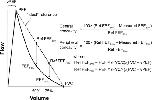 Figure 1 Variables used to quantify central and peripheral concavities (see text).