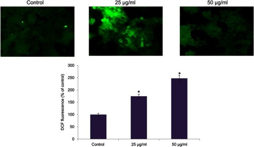 Figure 6 Apoptotic effect of biosynthesized gold nanoparticle from Chinese medicinal herb C. wenyujin (CWAuNPs) on ROS induction in renal carcinoma cell line A498. A498 cells were treated with 25 µg/ml and 50 µg/ml of CWAuNPs for 24 hours and after 24 hours of treatment, the control and treated cells were stained with 2’,7’-dichlorodihydrofluoresceindiacetate (H2DCFDA) for 15 minutes. The experiment was performed three times, and the representative images of each group are presented. *P<0.05.