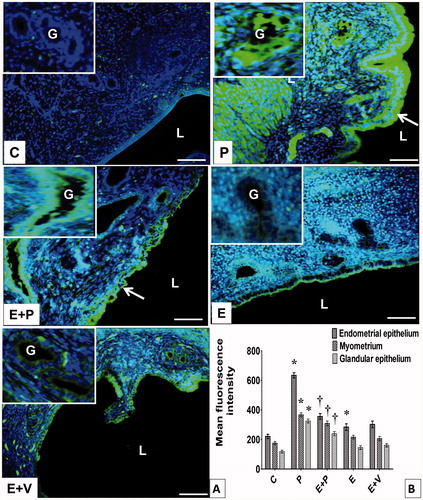 Figure 6. Distribution and expression levels of CAXII in uterus. (A) CAXII was distributed in different uterine compartments. Arrow pointing towards CAXII in endometrial epithelium. (B) Levels of CAXII protein in different uterine compartments. The highest fluorescence intensity for CAXII was observed in epithelia and myometrium of progesterone-treated rats. All data were expressed as mean ± SEM from four independent observations. *p < 0.05 compared to C, †p < 0.05 compared to E + V. E: estrogen, P: progesterone, C: control, V: vehicle (control), L: lumen, G: gland, Scale bar = 100 μM.