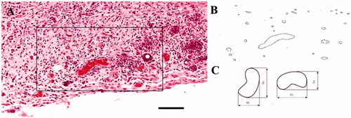 Figure 2. ROI determination for blood vessel quantification. (A) ROIs drawn in a representative wound bed area from d7 Capgel treated mouse and (B) the corresponding ImageJ-processed image. (C) Corresponing minimum Feret’s diameter determined by ImageJ. Scale bar =100 µm.