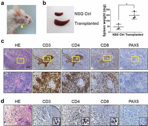 Figure 4. Histopathology of NSG mice transplanted with spleen cells from CTLA4-CD28 transgenic mice. (a) An NSG mouse with typical skin lesions in 9 weeks post transplantation. (b) Size and weight of spleen from NSG control and transplanted mice (n = 3 each). (*) represents P-value <0.05 from t-test. (c) H&E and immunostaining for CD3, CD4, CD8 and PAX5 in the spleen. Areas in the yellow box are shown in enlarged forms in the lower panels. (d) H&E and immunostaining for CD3, CD4, CD8 and PAX5 in the skin.