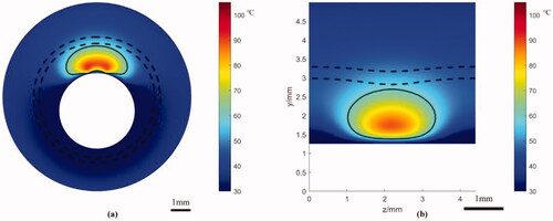 Figure 7. The temperature distribution after 6 s heating in the newly proposed thermoplasty: (a) Z cross-section; (b) Y cross-section. Scale bar: 1 mm.