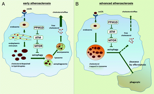 Figure 1. A role for PPM1D in atherosclerosis. In early atherosclerosis, macrophages take up oxLDL, process it and deposit cholesterol esters in the form of cytoplamic LDs as shown in (A). If autophagy is activated through the PPM1D-ATM-MTOR pathway, LDs are fused with autophagosome and subsequently with lysosomes, free cholesterol is produced, and it is subsequently effluxed from the cell. In advanced stages of atherosclerosis (B), cholesterol is trapped in lysosomes of foam cells. The prediction is that the PPM1D/ATM‐dependent inhibition of the MTOR pathway at this stage could also lead to activation of autophagy-dependent cholesterol efflux as well as LC3-associated clearance of dead cells.