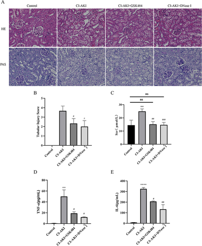 Figure 6 GSK484 or DNase I attenuates kidney injury in mice. (A) HE and PAS staining of mouse kidney tissue (magnification 400×). (B) Renal tubular injury score (n=6). (C) Expression of SCr in mice (n=6). (D and E) Expression levels of serum inflammatory factors TNF-α and IL-6 in mice (n=3). * VS control group, **P < 0.01, ****P < 0.0001, indicating statistically significant data between groups; # VS CI-AKI group, #P < 0.05, ##P < 0.01, ###P < 0.001, indicating statistically significant data between groups; ns indicates no statistical significance.
