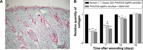 Figure S2 Collagen fiber regeneration in rat skin.Notes: (A) Masson-trichrome staining of normal skin. Blue-green staining intensity corresponds to relative quantity of deposited collagen fiber. (B) The relative quantity of collagen in normal, gauze, PVA/COS-AgNPs nanofiber, PVA/COS-AgNPs nanofiber plus SB431542 at 3, 7, 12, 18 days post-wounding. PVA/COS-AgNPs nanofiber group showed the greatest collagen synthesis. Values are mean ± standard deviation. *P<0.05 and **P<0.01 vs normal group, #P<0.05 and ##P<0.01 vs PVA/COS-AgNPs nanofiber plus SB431542 group.Abbreviations: PVA, poly(vinyl alcohol); COS, chitosan oligosaccharide; AgNPs, silver nanoparticles.