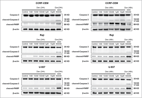 Figure 3. Dex induces apoptosis in CCRF-CEM cells. CCRF-CEM, Raji, and U-937 cells were treated with increasing concentrations of Dex for 24 and 48 h, and cleaved-PARP and cleaved-Caspase 3 were detected by Western blot. Cells were treated with 500 nM doxorubicin for 24 and 48 h as a positive control.