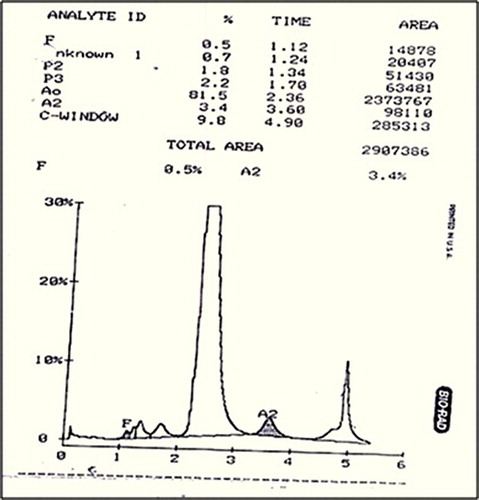 Figure 1. Cation-exchange HPLC analysis on the Variant Hb Testing System; HPLC analysis showed an abnormal peak in the C window – 9.8% with a retention time of 4.90 minutes.