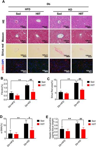 Figure 3 High-intensity interval training attenuated ketogenic diet-induced hepatic fibrosis and histological changes in livers of diabetic mice. Analysis of mice liver (A), fibrotic area (%) (B), Sirius Red area (%) (C), α-SMA (%) (D) and hepatic hydroxyproline levels (E). Immunostaining was performed to determine the α-SMA expression (red, 200×), and nuclear counterstaining was done using DAPI (blue). Scale bars: 100 μm. Data were presented as means ± SD (n=6 each group). Groups were statistically compared using two-way ANOVA and Bonferroni post hoc tests. **P <0.01, compared to Db+HFD+Sed group, #P <0.05, ##P <0.01 compared to Db+KD+Sed group.