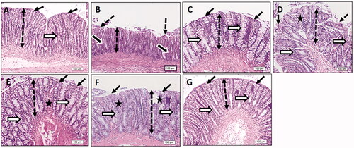 Figure 4. Olmesartan medoxomil self-microemulsifying drug delivery system (OMS) nanoformulation ameliorates histopathological damage in trinitrobenzene sulfonic acid (TNBS)-induced acute colitis in rats. Photomicrographs of colonic sections stained with hematoxylin & Eosin stain (× 20): (A) Normal control group showed intact epithelial surface (thin black arrows), normal-thickness mucosa (double-headed dotted arrow), and normal crypts (white arrows). (B) TNBS-colitic (Positive control) group showed a decreased height of colonic mucosa (double-headed dotted arrow), focal loss of surface epithelium (dotted arrows), dark stained degenerated crypts (thick black arrows), and inflammatory infiltration. (C) Sulfasalazine and (G) Olmesartan medoxomil self-microemulsifying drug delivery system high dose groups showed marked preservation of normal mucosal thickness (double-headed dotted arrow), intact surface epithelium (thin black arrows), normal crypts with increased goblet cells (white arrows), and diminished inflammatory cell invasion. (D) Olmesartan medoxomil low dose group showed mild improvement with focal surface epithelial loss (dotted arrows), a decreased height of colonic mucosa (double-headed dotted arrow), crypt disruption (white arrows), and focal crypt loss (star). (E) Olmesartan medoxomil high dose and (F) Olmesartan medoxomil self-microemulsifying drug delivery system low dose groups showed moderate preservation of normal colonic mucosal structure with a moderately-decreased height of colonic mucosa (double-headed dotted arrow), moderately intact epithelium (thin black arrows), few regions of crypt loss (star), and increased goblet cells (white arrows).