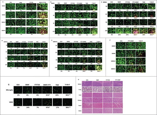 Figure 4. MMF interacts with FTY720 (Fingolimod, Gilenya) to kill GBM cells. (A) GBM cells were treated with vehicle or MMF (5 μM), FTY720 (50 nM) or both drugs in combination and viability determined 24 h later using a live / dead assay (n = 3 +/− SEM) * P < 0.05 greater than MMF alone. (B–E) GBM5, GBM6, GBM12, GBM14 cells were treated with MMF (5 μM), FTY720 (50 nM), Temozolomide (TMZ, 3 μM) or in combination as indicated for the times (3 h–12 h) as indicated. Cell viability was assessed by live / dead assay. (n = 3 +/− SEM) *P < 0.05 greater than MMF; **P < 0.05 greater than MMF+FTY720 value. (F) GBM cells were treated with MMF+FTY720 or with MMF+FTY720+TMZ for 12 h. Cells were washed free of drug, and cell growth / repopulation permitted to occur for 48 h. Cell viability was assessed by live / dead assay. (G) GBM tumors, fresh from the operating room, were gently digested and dissociated, and microglia and primary GBM cells purified. Cells were plated and 12 h after plating were treated with MMF (5 μM), FTY720 (50 nM), Temozolomide (TMZ, 3 μM) or in combination as indicated for 12 h. Cell viability was assessed by live / dead assay. (n = 3 +/− SEM) *P < 0.05 greater than MMF; **P < 0.05 greater than MMF+FTY720 value. (H) BALB/c immune competent mice were treated for 14 d with: vehicle (cremophore); DMF (75 mg/kg); FTY720 (0.6 mg/kg) or the drugs in combination. After 14 d the mice were sacrificed and their organs fixed. Sections (10 μm) or each organ were taken and stained with H&E.