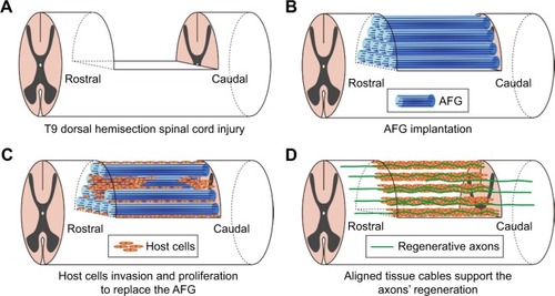 Figure 8 Summarized schematic of regrowth process with AFG implantation in rat dorsal semi-section SCI model. For the T9 dorsal hemisection SCI (A), the AFG scaffold was implanted into the injury site to bridge the gap (B). Then, the host cells migrated into the AFG scaffold to replace the aligned structure (C) which supports the axons’ regeneration (D).Abbreviations: AFG, aligned fibrin hydrogel; SCI, spinal cord injury.
