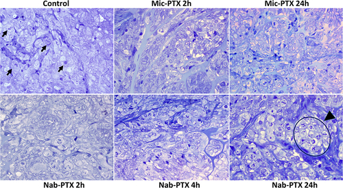 Figure 4 Toluidine blue stained semithin sections of glutaraldehyde fixed resin embedded SK-OV-3 Luc IP1 tumor xenografts, exposed to saline, to Nab-PTX for 2h, 4h and 24h and to Mic-PTX for 2 and 24h. Mic-PTX treated xenografts demonstrated a lightly increased mitotic count. Nab-PTX induced mitotic catastrophe in xenografts. The mitotic index increased with increasing exposure to Abraxane (24h > 4h > 2h > control). Some mitotic figures are indicated in the control condition (arrowhead); a large cluster of mitotic cells is indicated in the condition where cells are exposed to Abraxane for 24h (arrowhead). Mitotic cells in cultures exposed to Abraxane displayed abnormal DNA condensation. There was no increase in apoptotic cells.