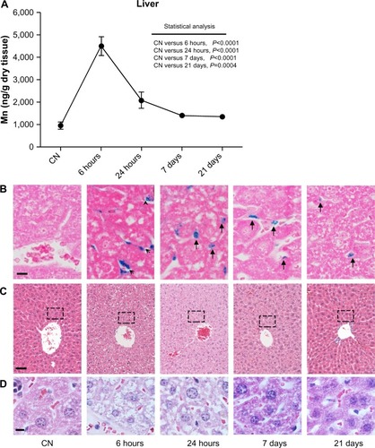 Figure 3 (A–D) Quantitative determination of nanoparticles in the liver and histological evaluation. (A) Changes in Mn levels at 6 hours, 24 hours, 7 days, and 21 days after intravenous injection. Data are presented as means ± standard error of mean (n=6). (B) Representative images of liver sections stained with Prussian blue to detect iron deposits (arrows and arrowhead) in the tissue at each time point; bar 10 μm. (C) Images of liver sections stained with hematoxylin and eosin showing normal tissue architecture; bar 50 μm. (D) High magnification (bar 10 μm) of liver region around the central vein (indicated with the dashed box in (C) at each time point reveals hydropic swelling of hepatocytes, particularly at 6 hours after nanoparticle injection. This cellular phenomenon is completely reversible, as confirmed by the normal appearance of hepatocytes at longer experimental times.Abbreviation: CN, vehicle-treated mice.