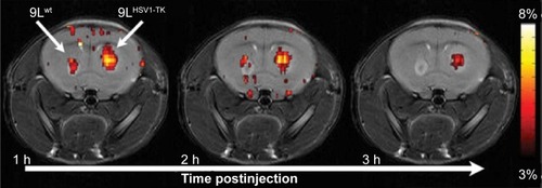 Figure 2 High-resolution MRI images.Notes: Brain has two tumors, a control (wt) and a glioma expressing a recombinant MRI reporter HSV1-TK, highlighted using CEST imaging.Abbreviations: MRI, magnetic resonance imaging; HSV1-TK, herpes simplex virus type-1 thymidine kinase; CEST, chemical exchange saturation transfer; h, hour.