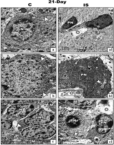 Figure 8. Transmission electron micrograph (TEM) through the basket (panel a&a1), Purkinje (panel b&b1) and granular (panel c&c1) cells of the cerebellar cortex of control and IS maternally induced rats offspring respectively. The cellular images from IS cerebellar cortex (a1-c1) there are pyknotic nuclei (PN), vacuoalted cytoplasm (white asterisks), dilated and de-granulated RER (double arrow heads), condensed Golgi bodies (black asterisk) and atrophied and vacuolated mitochondria (zigzag arrows). (Scale bar is indicated in the lower left handed side for each image).