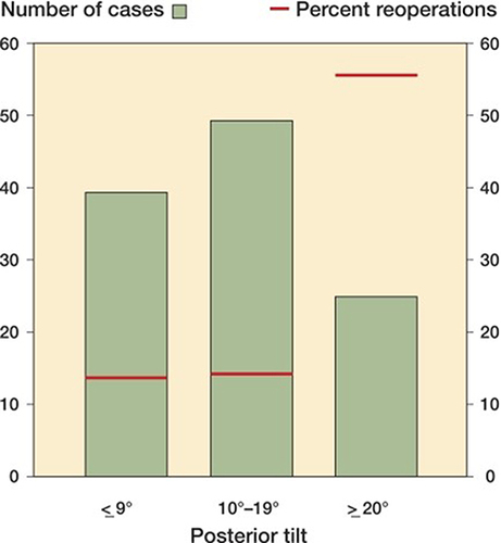 Figure 3 Distribution of posterior tilt and rates of reoperation in the 113 patients who were operated on with internal fixation for a Garden I or II femoral neck fracture. Bar graphs represent the total number of cases and red lines represent the percent of the group that underwent reoperation, shown to be disproportionately greater in patients with a posterior tilt >20°.
