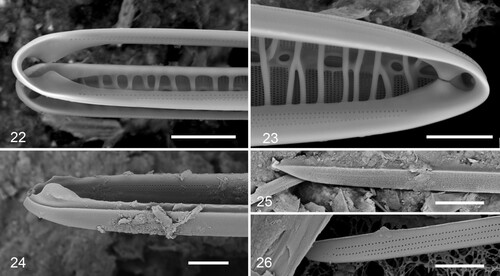 Figs 22–26. Gomphotheca marciae n. sp., copulae (SEM). Figs 22, 23. Basal and apical details of valvocopula in situ adjacent to the valve, showing that this band is closed and showing overlap of silica flaps on valvocopula with pseudoseptum on valve. Fig. 24. Oblique view of valvocopula showing silica flaps and ruffled groove of pars interior. Figs 25, 26. Open (basal) ends of a second copula showing external and internal poration. Scale bars 5 µm.