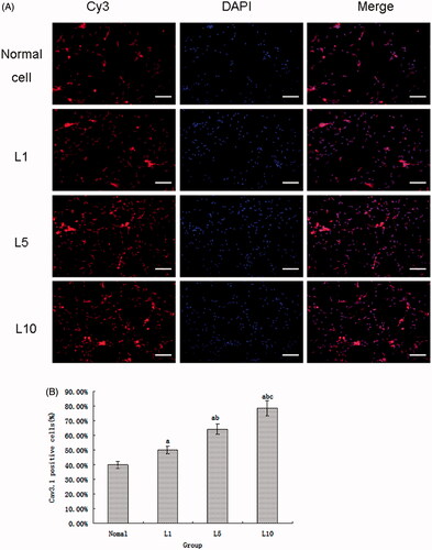 Figure 4. (A) The Cav3.1 expression of the cultured cells untreated or treated with lidocaine hydrochloride (Cy3-DAPI, 200×, bar = 20μm). Cy3 indicated the Cav3.1 protein expression, DAPI staining indicated the nucleus, and the merged image was the combination of those two pictures (normal cells: untreated with lidocaine hydrochloride; L1: cells treated with 1 mM lidocaine hydrochloride for 24 h; L5: cells treated with 5 mM lidocaine hydrochloride for 24 h; L10: cells treated with 10 mM lidocaine hydrochloride for 24 h). (B) The Cav3.1 positive cells analysis (mean ± sd, n = 6), ap < .05 versus normal cells, bp < .05 versus cells in the L1 group L1; cp < .05 versus cells in L5 group.