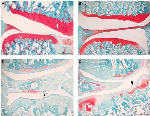 Figure 3 Histopathology of knee joint sections stained with Safranin-O and Fast Green. Control-Vehicle (A) and Control-TLR4A1 (B) animals show unaltered articular cartilage (in red) and subchondral bone. OA-Vehicle (C) and OA-TLR4A1 animals (D) showed decrease in proteoglycan staining (*), chondrocyte death, loss of intercellular matrix, decrease of the thickness of the articular cartilage (arrow) and erosion of the hyaline articular cartilage (arrowhead).