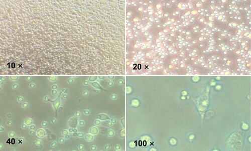 Figure 4. Morphology of primary peritoneal macrophages.