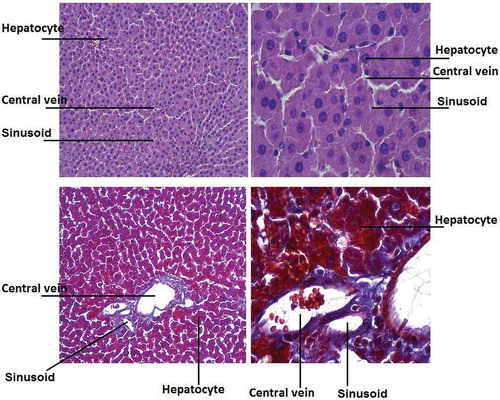 Figure 3. Microscopy of liver samples in diabetic rats receiving gavage of walnut oil with low dose of β-sitosterol; (a) H&E (20 µm); (b) H&E (100 µm); (c) trichrome (20 µm); (d) trichrome (100 µm).