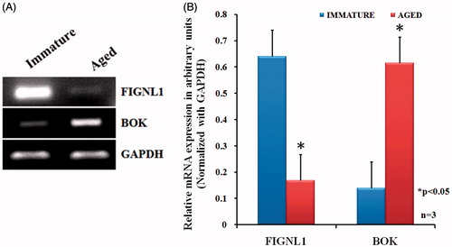 Figure 3. Semi-quantitative RT-PCR for FIGNL1 and BOK. Total RNA isolated from immature and aged rat primordial follicles, reverse transcribed, and the complementary DNA subjected to semi-quantitative RT-PCR in a linear range of amplification with GAPDH as an internal control. Representative image of three independent experiments are shown in Panel A. A graphical representation of results is presented in Panel B. Data from three independent experiments were expressed as arbitrary densitometric units (mean ± SEM). *p < 0.05 compared with immature rat primordial follicles.