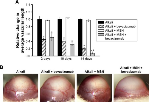 Figure 5 MSN-encapsulated bevacizumab nanoparticles enhance the inhibitory effect of bevacizumab on corneal neovascularization.Notes: (A) The corneas of male C57BL/6 mice were soaked with NaOH (0.1 M) on the central regions for 30 seconds to induce corneal neovascularization. They received subconjunctival injection of MSN-encapsulated bevacizumab nanoparticles, MSN-PEG-NH2, or bevacizumab after alkali injury. The relative change of new vessel length was determined 2, 7, or 14 days after alkali injury. *Significant difference compared with alkali group. #Significant difference between alkali + bevacizumab and alkali + MSN-encapsulated bevacizumab group. (B) A representative image of corneal neovascularization is shown at 14 days after alkali injury.Abbreviation: MSN, mesoporous silica nanoparticle.