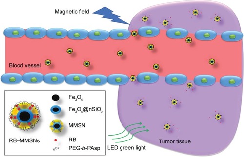 Figure 1 Illustration of MMSN-mediated treatment in a magnetic field.Note: RB was loaded into the mesoporous silica pores and surrounded by PEG-b-PAsp in blood vessels, when they were released in tumor sites.Abbreviations: MMSN, magnetic mesoporous silica nanoparticle; RB, rose bengal; PEG-b-PAsp, polyethylene glycol-b-poly(aspartic acid); RB−MMSNs, polyethylene glycol-b-polyaspartate-modified rose bengal-loaded magnetic mesoporous silica.