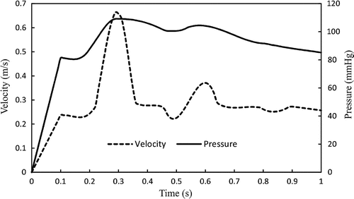 Figure 2. Inlet velocity and outlet pressure boundary conditions.