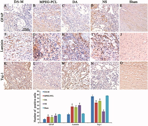 Figure 9 (A–E). GFAP, (F–J) Tuj-1 and (K–O) laminin immunohistochemical analysis. Spinal cord sections from the groups treated with intravenous DA-M, free DA, blank MPEG-PCL micelles and normal saline (NS) were subjected to immunohistochemistry to detect GFAP, Tuj-1 and laminin. (P) Quantification comparison of GFAP, laminin and Tuj-1positive cells in DA-M-treated and other groups. Significance was assessed by one-way analysis of variance. Quantitative data are represented as mean ± SD. p Values less than 0.05 were considered significant (*p < 0.05, #p < 0.01). Scale bars represent 100 μm.