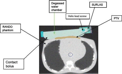 Figure 4. SURLAS positioned with its long axis parallel to the longitudinal axis of the RANDO phantom simulating treatment to the superficial PTV.