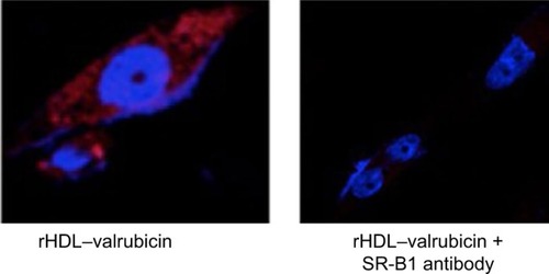 Figure 9 Confocal microscopey images (A and B) of rHDL–valrubicin uptake by MDA-MB-231 cells following pretreatment with an SR-B1 antibody. Magnification ×40.
