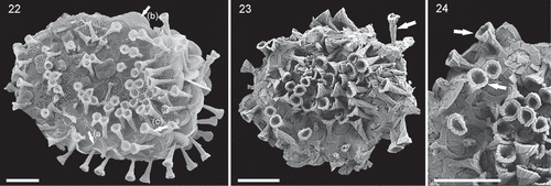 Figs 22–24. SEM micrographs of Palusphaera bownii sp. nov. Scale bar = 2 μm