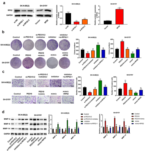Figure 6. LncRNA PEG10 silencing inhibited the proliferation, migration, and invasion of NB cells via modulating the miR-449a/RPS2 axis. (a) RPS2 expression in SK-N-BE (2) and SH-SY5Y cells was tested using Western blotting. (b) The proliferation of SK-N-BE (2) and SH-SY5Y cells was tested via clone formation assay. (c) The invasion of SK-N-BE (2) and SH-SY5Y cells was detected by Transwell assay. (d) The protein expression of MMP-2, MMP-9, and MMP-14 in SK-N-BE (2) and SH-SY5Y cells were detected via Western blotting. **P < 0.01, compared with control group; ##P < 0.01, compared with si-PEG10-2 or PEG10 group; &&P < 0.01, compared with mimic or inhibitor group.