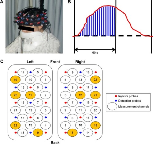 Figure 3 NIRS measurement and analysis.