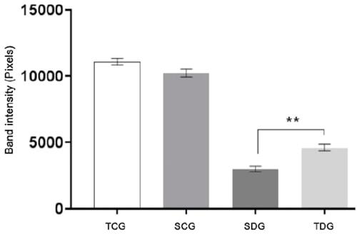 Figure 4 Means (M), standard deviation (SD) and significance of albumin serum concentrations identified in polyacrylamide gel electrophoresis (SDS-PAGE) from rats submitted to physical activity. Values represent mean±standard error. ** Significant statistical differences (P<0.05).