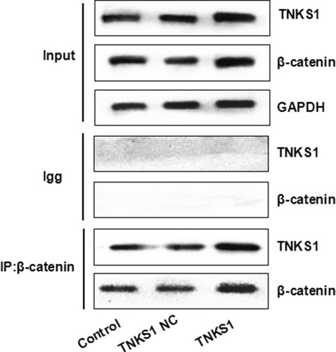 Figure 8 Co-immunoprecipitation assays with β-catenin antibody for TNKS1 using U251 cell lysates before transfection (Control) or transfected with empty vector (TNKS1 NC) or TNKS1 overexpression vector (TNKS1).